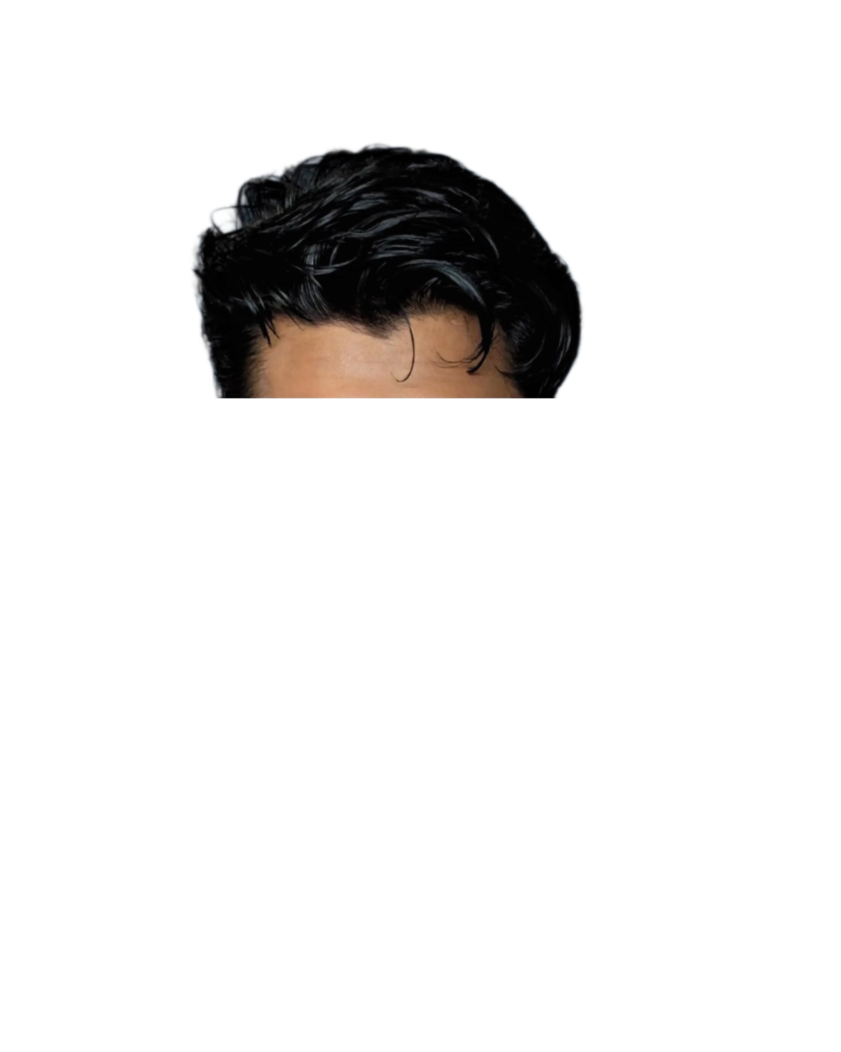 Forehead section of Mir Ahadul Islam with eyes open